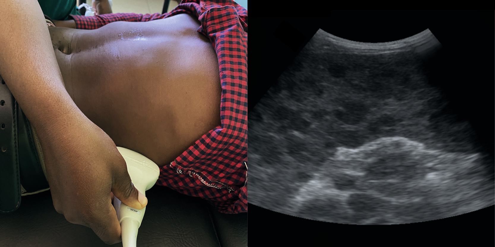 SS1 Ultrasound of lymph nodes and spleen - FASH