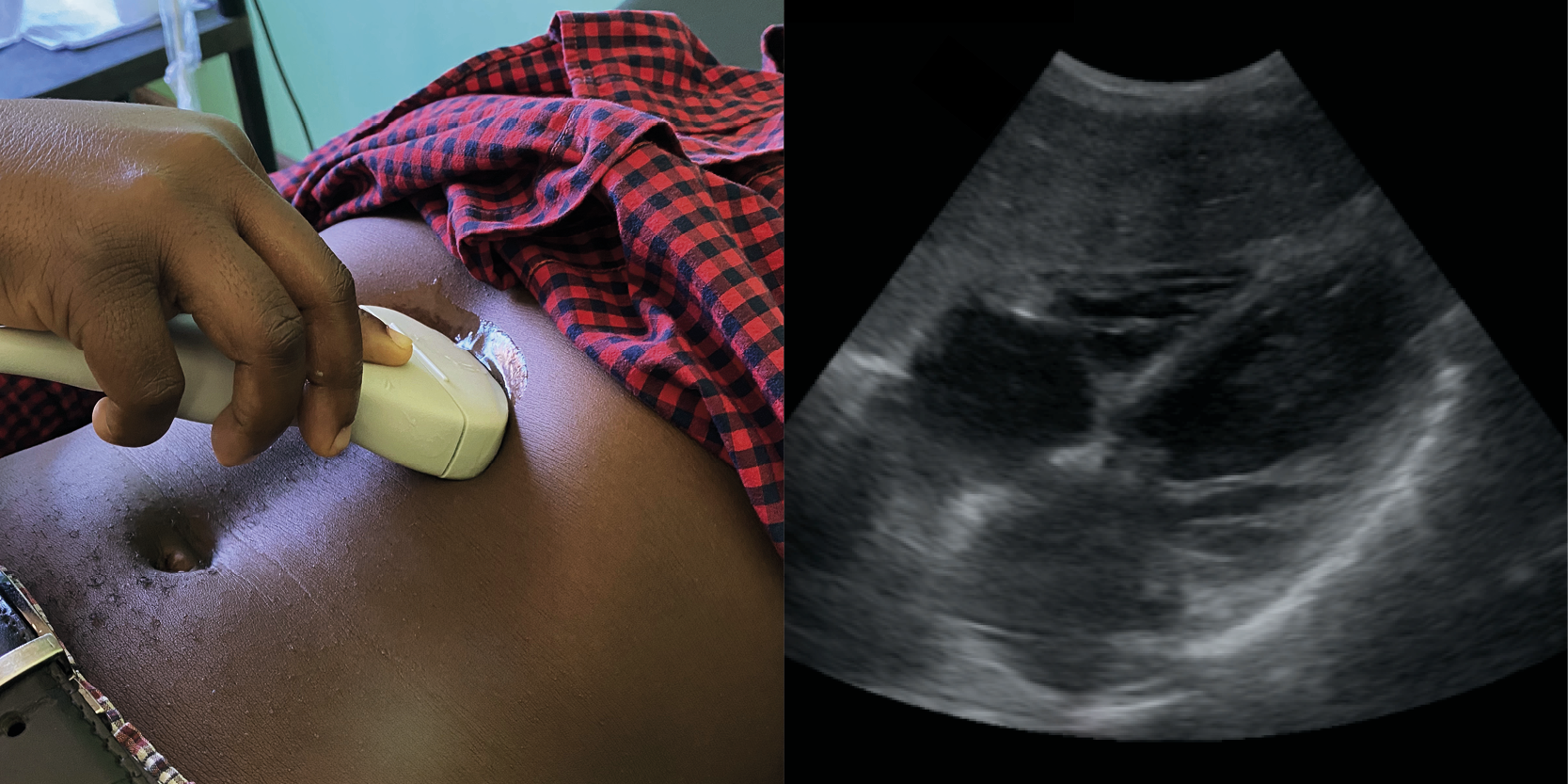 SS3 Ultrasound of the heart – CURLS